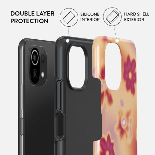 Divine - Xiaomi 11 Lite 5G NE Case 2