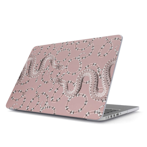 Poolside Glam - Macbook Case 1