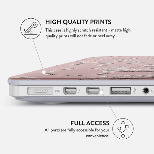 Poolside Glam - Macbook Case 20