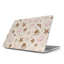 Beach Games - Macbook Case 1