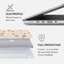 Beach Games - Macbook Case 18