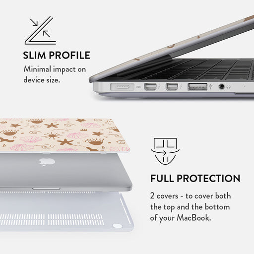 Beach Games - Macbook Case 18