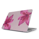 Fragile Beauty - Macbook Case 1