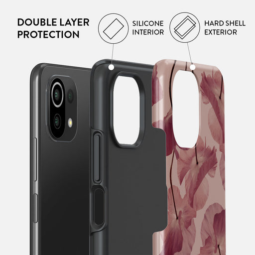 Tender Kiss - Xiaomi 11 Lite 5G NE Case 2