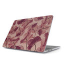 Tender Kiss - Macbook Case 1