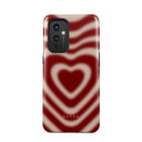 Sweet Affair - OnePlus 9 Case 1