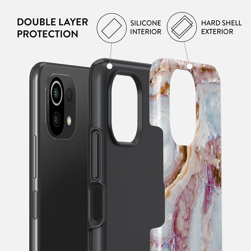 Frozen Leaves - Cute Marble Xiaomi 11 Lite 5G NE Case 2