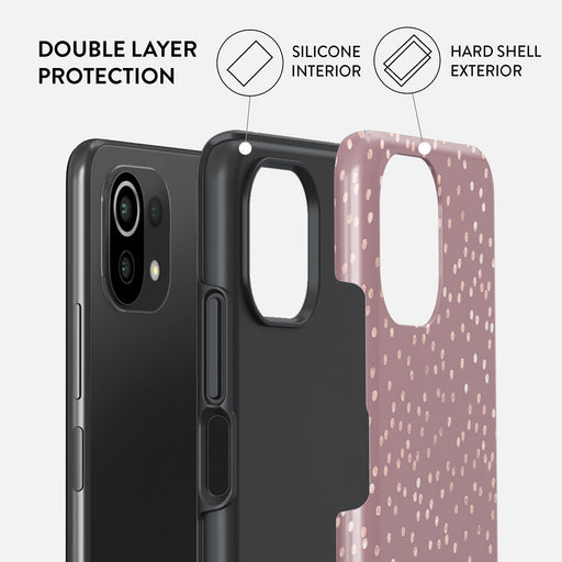 Hot Cocoa - Spotted Xiaomi Mi 11 Lite 4G / 5G Case 2