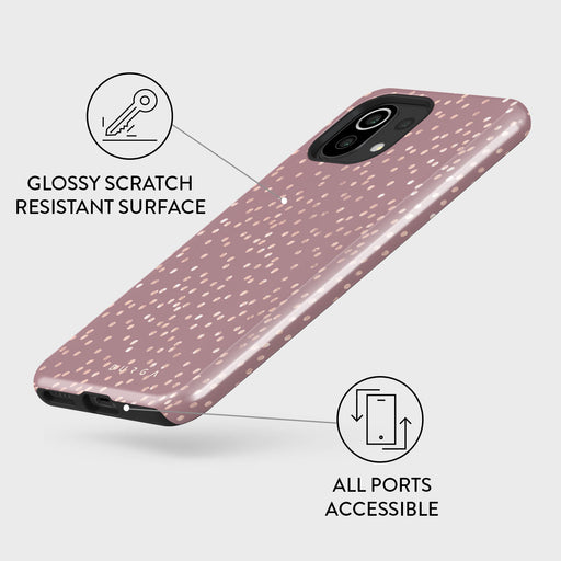 Hot Cocoa - Spotted Xiaomi Mi 11 Lite 4G / 5G Case 3